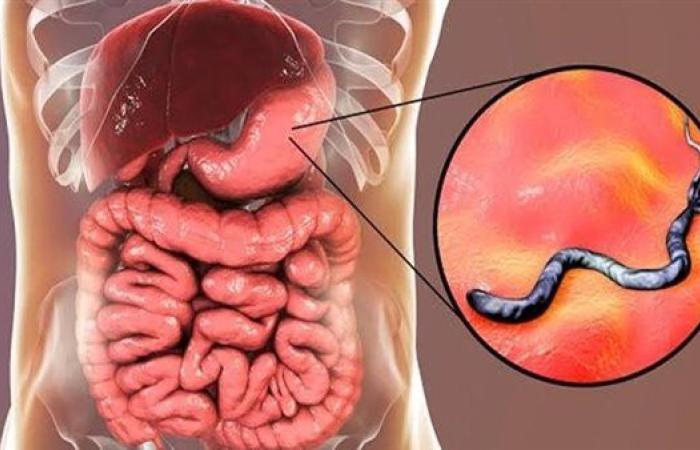 مخاطر جرثومة المعدة وطرق علاجها